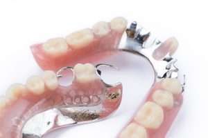 Dental bone grafting procedure illustration